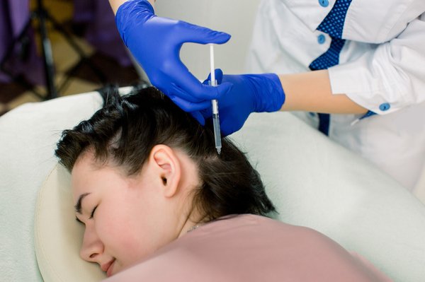 Top 5 raisons de choisir le prp pour lutter contre la perte de cheveux